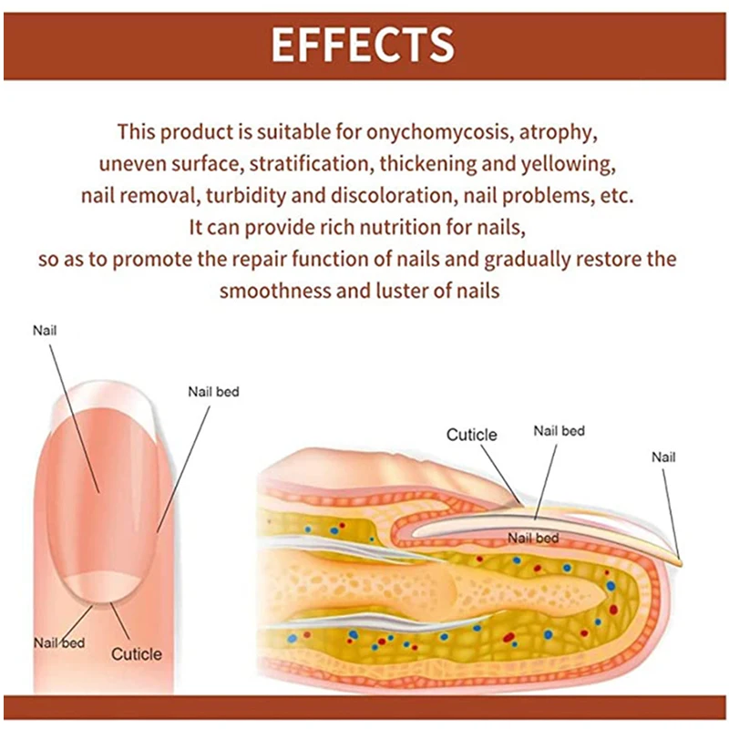7 ZILE de Reparare Ciuperca Unghiilor Tratamente Esența Picior de Îngrijire Ser Deget de la picior Unghiilor Fungice Îndepărtarea Gel Anti-Infecție Onychomycosis Imagine 4